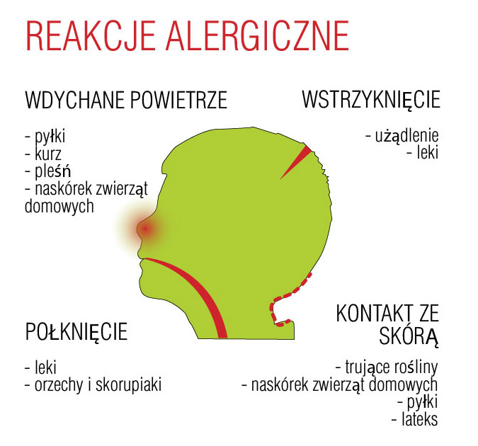 Reakcje Alergiczne